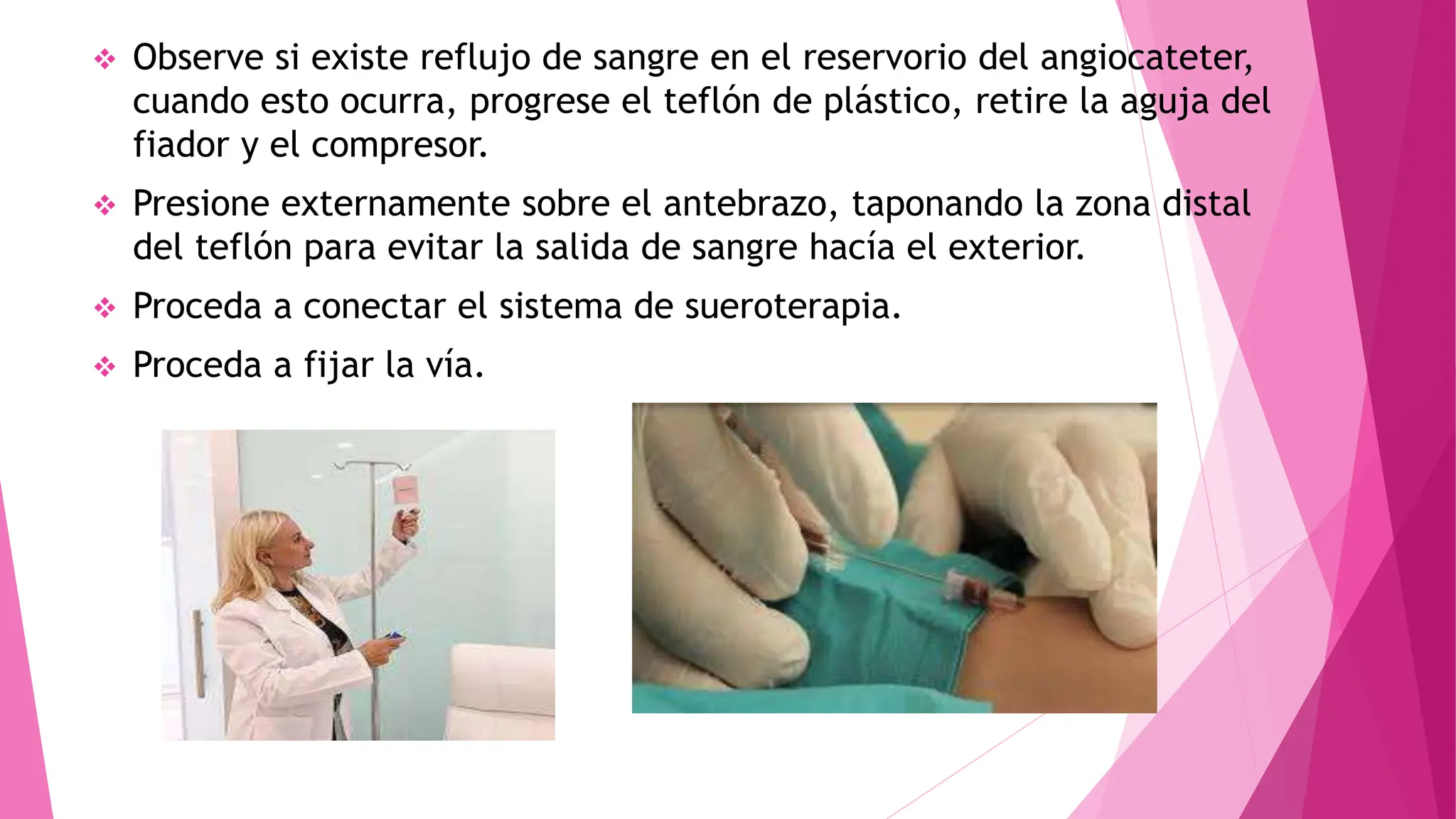  Observe si existe reflujo de sangre en el reservorio del angiocateter,
cuando esto ocurra, progrese el teflón de plástico, retire la aguja del
fiador y el compresor.
 Presione externamente sobre el antebrazo, taponando la zona distal
del teflón para evitar la salida de sangre hacía el exterior.
 Proceda a conectar el sistema de sueroterapia.
 Proceda a fijar la vía.
 