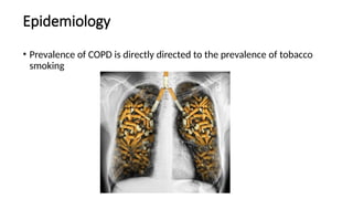 Epidemiology
• Prevalence of COPD is directly directed to the prevalence of tobacco
smoking
 