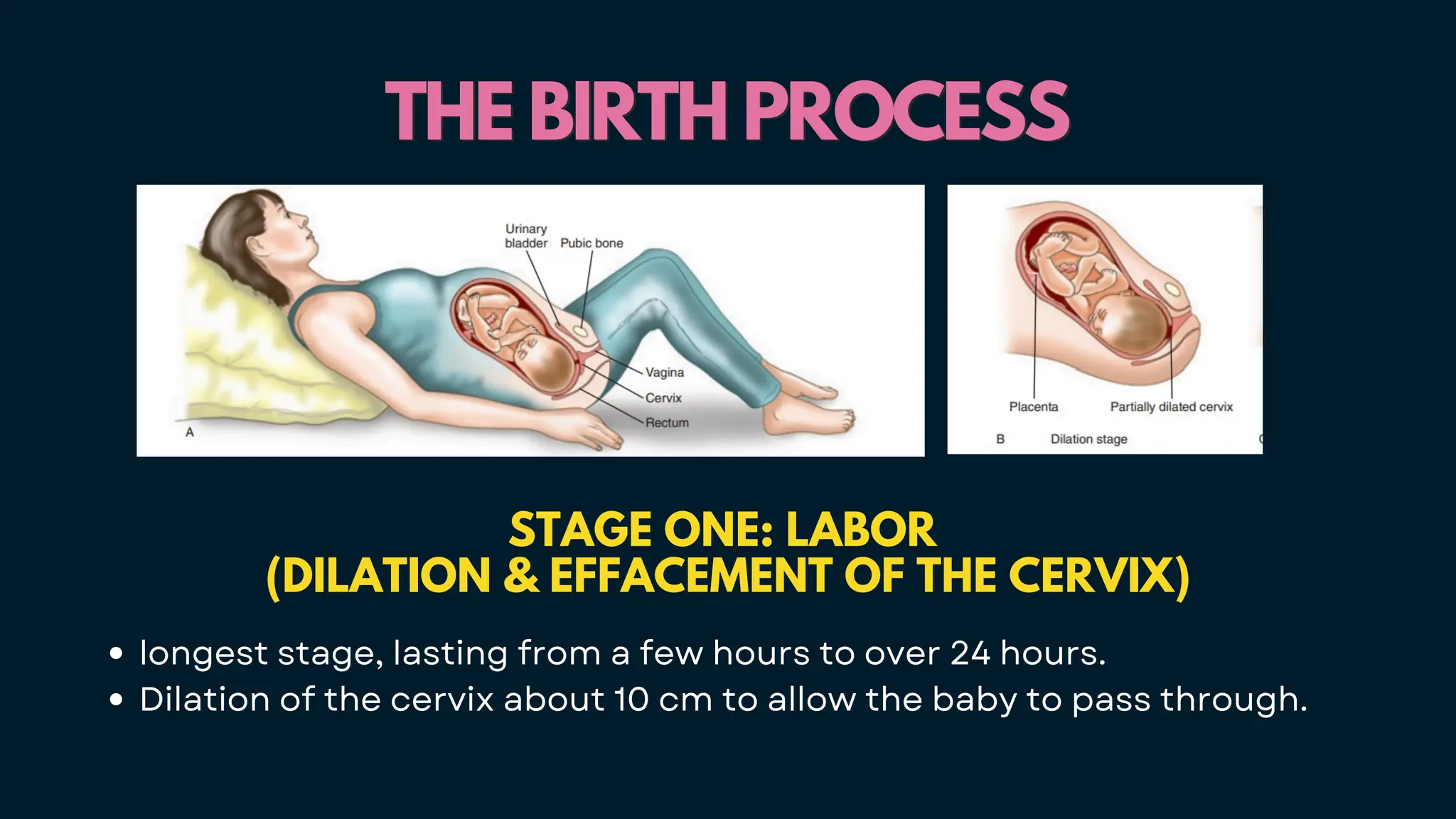 THE BIRTH PROCESS
THE BIRTH PROCESS
STAGE ONE: LABOR
(DILATION & EFFACEMENT OF THE CERVIX)
longest stage, lasting from a few hours to over 24 hours.
Dilation of the cervix about 10 cm to allow the baby to pass through.
 