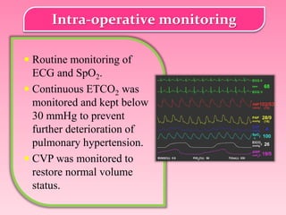 Preoperative Incidental Detection & Anaesthetic Management of Valvular Heart Disease in Emergency LUCS