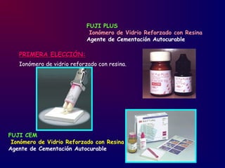 PRIMERA ELECCIÓN:PRIMERA ELECCIÓN:
Ionómero de vidrio reforzado con resina.
FUJI PLUS
Ionómero de Vidrio Reforzado con Resina
Agente de Cementación Autocurable
FUJI CEM
Ionómero de Vidrio Reforzado con Resina
Agente de Cementación Autocurable
 