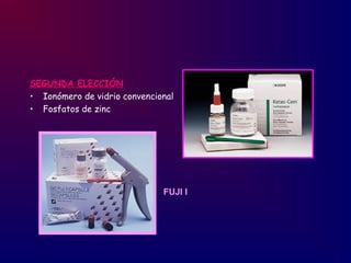SEGUNDA ELECCIÓN
• Ionómero de vidrio convencional
• Fosfatos de zinc
FUJI I
 