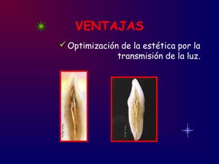 VENTAJAS
Optimización de la estética por la
transmisión de la luz.
 