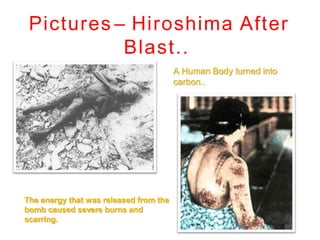 Pictures – Hiroshima After
Blast..
A Human Body turned into
carbon..
The energy that was released from the
bomb caused severe burns and
scarring.
 