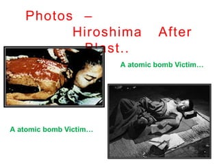 Photos –
Hiroshima After
Blast..
A atomic bomb Victim…
A atomic bomb Victim…
 