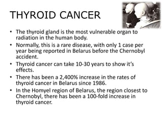 THYROID CANCER
• The thyroid gland is the most vulnerable organ to
radiation in the human body.
• Normally, this is a rare disease, with only 1 case per
year being reported in Belarus before the Chernobyl
accident.
• Thyroid cancer can take 10-30 years to show it’s
effects.
• There has been a 2,400% increase in the rates of
thyroid cancer in Belarus since 1986.
• In the Homyel region of Belarus, the region closest to
Chernobyl, there has been a 100-fold increase in
thyroid cancer.
 