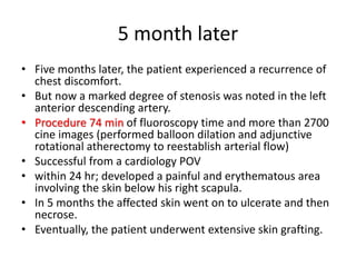 5 month later
• Five months later, the patient experienced a recurrence of
chest discomfort.
• But now a marked degree of stenosis was noted in the left
anterior descending artery.
• Procedure 74 min of fluoroscopy time and more than 2700
cine images (performed balloon dilation and adjunctive
rotational atherectomy to reestablish arterial flow)
• Successful from a cardiology POV
• within 24 hr; developed a painful and erythematous area
involving the skin below his right scapula.
• In 5 months the affected skin went on to ulcerate and then
necrose.
• Eventually, the patient underwent extensive skin grafting.
 