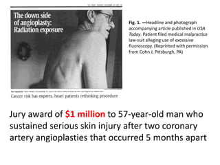 Fig. 1. —Headline and photograph
accompanying article published in USA
Today. Patient filed medical malpractice
law-suit alleging use of excessive
fluoroscopy. (Reprinted with permission
from Cohn J, Pttsburgh, PA)
Jury award of $1 million to 57-year-old man who
sustained serious skin injury after two coronary
artery angioplasties that occurred 5 months apart
 