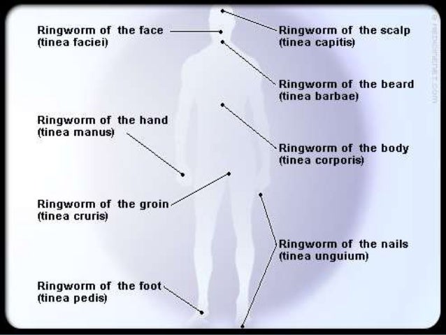 dermatophyte infections #10