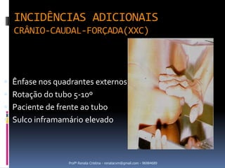 INCIDÊNCIAS ADICIONAIS
  CRÂNIO-CAUDAL-FORÇADA(XXC)




 Ênfase nos quadrantes externos
 Rotação do tubo 5-10º
 Paciente de frente ao tubo
 Sulco inframamário elevado




                 Profª Renata Cristina - renatacvm@gmail.com - 96984689
 