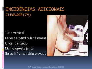 INCIDÊNCIAS ADICIONAIS
  CLEAVAGE(CV)



 Tubo vertical
 Feixe perpendicular à mama
 QI centralizado
 Mama oposta junta
 Sulco inframamário elevado


                    Profª Renata Cristina - renatacvm@gmail.com - 96984689
 
