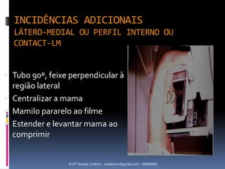 INCIDÊNCIAS ADICIONAIS
  LÁTERO-MEDIAL OU PERFIL INTERNO OU
  CONTACT-LM


 Tubo 90º, feixe perpendicular à
  região lateral
 Centralizar a mama
 Mamilo pararelo ao filme
 Estender e levantar mama ao
  comprimir


                 Profª Renata Cristina - renatacvm@gmail.com - 96984689
 