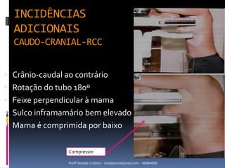 INCIDÊNCIAS
  ADICIONAIS
  CAUDO-CRANIAL-RCC


 Crânio-caudal ao contrário
 Rotação do tubo 180º
 Feixe perpendicular à mama
 Sulco inframamário bem elevado
 Mama é comprimida por baixo


                 Compressor

                 Profª Renata Cristina - renatacvm@gmail.com - 96984689
 