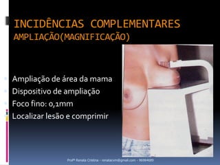 INCIDÊNCIAS COMPLEMENTARES
  AMPLIAÇÃO(MAGNIFICAÇÃO)



 Ampliação de área da mama
 Dispositivo de ampliação
 Foco fino: 0,1mm
 Localizar lesão e comprimir




                 Profª Renata Cristina - renatacvm@gmail.com - 96984689
 