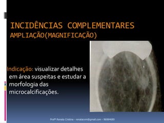 INCIDÊNCIAS COMPLEMENTARES
 AMPLIAÇÃO(MAGNIFICAÇÃO)



Indicação: visualizar detalhes
 em área suspeitas e estudar a
 morfologia das
 microcalcificações.



                Profª Renata Cristina - renatacvm@gmail.com - 96984689
 