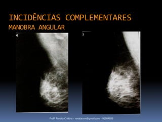 INCIDÊNCIAS COMPLEMENTARES
MANOBRA ANGULAR




          Profª Renata Cristina - renatacvm@gmail.com - 96984689
 