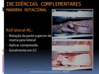 INCIDÊNCIAS COMPLEMENTARES
MANOBRA ROTACIONAL



Roll lateral-RL:
 Rotação da parte superior da
  mama para lateral
 Aplicar compressão
 Geralmente em CC




                Profª Renata Cristina - renatacvm@gmail.com - 96984689
 