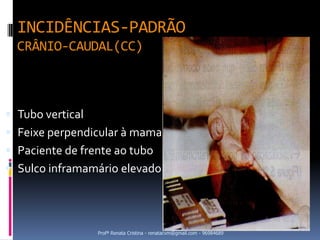 INCIDÊNCIAS-PADRÃO
  CRÂNIO-CAUDAL(CC)



 Tubo vertical
 Feixe perpendicular à mama
 Paciente de frente ao tubo
 Sulco inframamário elevado




                  Profª Renata Cristina - renatacvm@gmail.com - 96984689
 