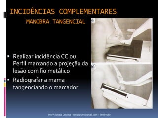 INCIDÊNCIAS COMPLEMENTARES
       MANOBRA TANGENCIAL




 Realizar incidência CC ou
  Perfil marcando a projeção da
  lesão com fio metálico
 Radiografar a mama
  tangenciando o marcador



               Profª Renata Cristina - renatacvm@gmail.com - 96984689
 