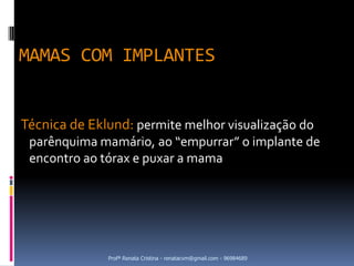 MAMAS COM IMPLANTES


Técnica de Eklund: permite melhor visualização do
 parênquima mamário, ao “empurrar” o implante de
 encontro ao tórax e puxar a mama




              Profª Renata Cristina - renatacvm@gmail.com - 96984689
 