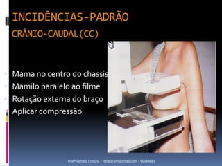 INCIDÊNCIAS-PADRÃO
  CRÂNIO-CAUDAL(CC)



 Mama no centro do chassis
 Mamilo paralelo ao filme
 Rotação externa do braço
 Aplicar compressão




                 Profª Renata Cristina - renatacvm@gmail.com - 96984689
 