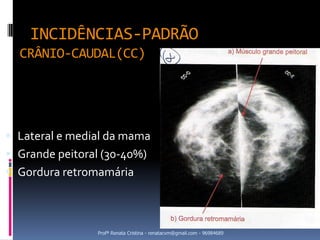 INCIDÊNCIAS-PADRÃO
  CRÂNIO-CAUDAL(CC)




 Lateral e medial da mama
 Grande peitoral (30-40%)
 Gordura retromamária



                Profª Renata Cristina - renatacvm@gmail.com - 96984689
 