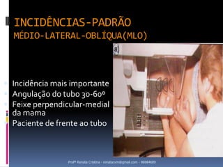 INCIDÊNCIAS-PADRÃO
  MÉDIO-LATERAL-OBLÍQUA(MLO)



 Incidência mais importante
 Angulação do tubo 30-60º
 Feixe perpendicular-medial
  da mama
 Paciente de frente ao tubo



                 Profª Renata Cristina - renatacvm@gmail.com - 96984689
 