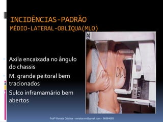 INCIDÊNCIAS-PADRÃO
  MÉDIO-LATERAL-OBLÍQUA(MLO)



 Axila encaixada no ângulo
  do chassis
 M. grande peitoral bem
  tracionados
 Sulco inframamário bem
  abertos

                 Profª Renata Cristina - renatacvm@gmail.com - 96984689
 