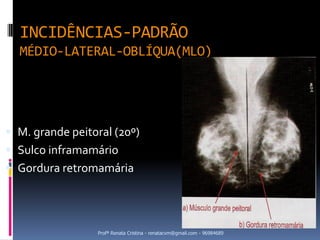INCIDÊNCIAS-PADRÃO
  MÉDIO-LATERAL-OBLÍQUA(MLO)




 M. grande peitoral (20º)
 Sulco inframamário
 Gordura retromamária




                 Profª Renata Cristina - renatacvm@gmail.com - 96984689
 