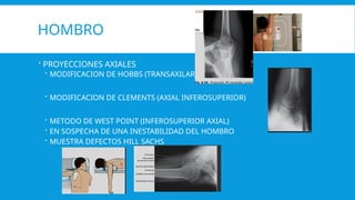INCIDENCIAS RADIOLOGICAS.pptx MMMMMMMMMMMMMMMMMM | PPTX