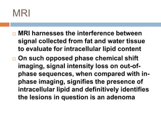 MRI
 MRI harnesses the interference between
signal collected from fat and water tissue
to evaluate for intracellular lipid content
 On such opposed phase chemical shift
imaging, signal intensity loss on out-of-
phase sequences, when compared with in-
phase imaging, signifies the presence of
intracellular lipid and definitively identifies
the lesions in question is an adenoma
 