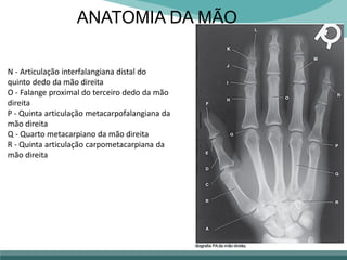 ANATOMIA DA MÃO
N - Articulação interfalangiana distal do
quinto dedo da mão direita
O - Falange proximal do terceiro dedo da mão
direita
P - Quinta articulação metacarpofalangiana da
mão direita
Q - Quarto metacarpiano da mão direita
R - Quinta articulação carpometacarpiana da
mão direita
 