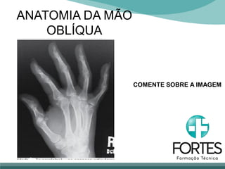 ANATOMIA DA MÃO
OBLÍQUA
COMENTE SOBRE A IMAGEM
 