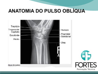 ANATOMIA DO PULSO OBLÍQUA
 