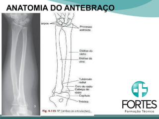 ANATOMIA DO ANTEBRAÇO
 