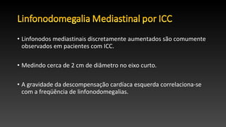 • Linfonodos mediastinais discretamente aumentados são comumente
observados em pacientes com ICC.
• Medindo cerca de 2 cm de diâmetro no eixo curto.
• A gravidade da descompensação cardíaca esquerda correlaciona-se
com a freqüência de linfonodomegalias.
 