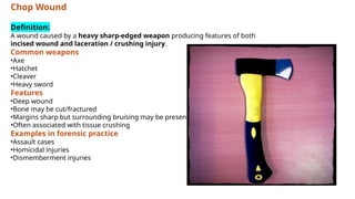 Comprehensive Forensic Analysis of Incised and Stab Wounds in Sharp ...