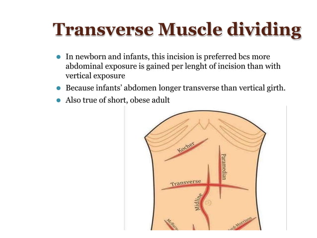 Incision.pptx