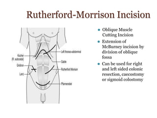 Incision.pptx