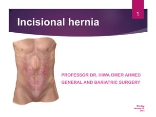Monday,
January 23,
2023
1
Incisional hernia
PROFESSOR DR. HIWA OMER AHMED
GENERAL AND BARIATRIC SURGERY
 