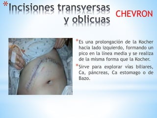 *
*Es una prolongación de la Kocher
hacia lado izquierdo, formando un
pico en la línea media y se realiza
de la misma forma que la Kocher.
*Sirve para explorar vías biliares,
Ca, páncreas, Ca estomago o de
Bazo.
CHEVRON
 