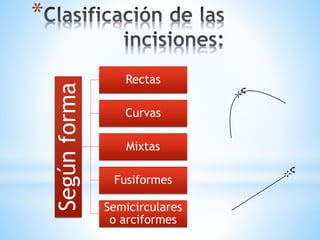 *
Segúnforma Rectas
Curvas
Mixtas
Fusiformes
Semicirculares
o arciformes
 