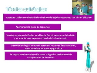 Apertura cutánea con bisturí frío e incisión del tejido subcutáneo con bisturí eléctrico
Apertura de la fascia de los rectos
Se colocan pinzas de Kocher en el borde fascial externo de la incisión
y se levanta para exponer el borde del músculo recto
Disección de la grasa entre el borde del recto y su fascia anterior,
hasta visualizar los vasos epigástricos
Se separa mediante disección roma o digital el peritoneo de la
cara posterior de los rectos
 