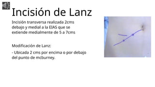 Tipos de Incisiones Abdominales en cirugia.ppsx