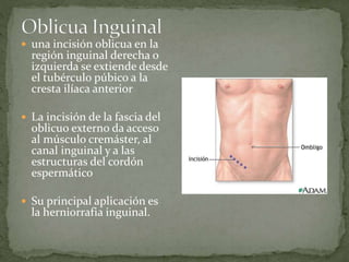  una incisión oblicua en la
región inguinal derecha o
izquierda se extiende desde
el tubérculo púbico a la
cresta ilíaca anterior
 La incisión de la fascia del
oblicuo externo da acceso
al músculo cremáster, al
canal inguinal y a las
estructuras del cordón
espermático
 Su principal aplicación es
la herniorrafia inguinal.
 