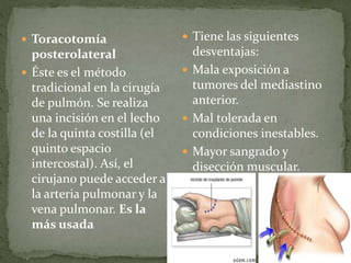  Toracotomía
posterolateral
 Éste es el método
tradicional en la cirugía
de pulmón. Se realiza
una incisión en el lecho
de la quinta costilla (el
quinto espacio
intercostal). Así, el
cirujano puede acceder a
la arteria pulmonar y la
vena pulmonar. Es la
más usada
 Tiene las siguientes
desventajas:
 Mala exposición a
tumores del mediastino
anterior.
 Mal tolerada en
condiciones inestables.
 Mayor sangrado y
disección muscular.
 