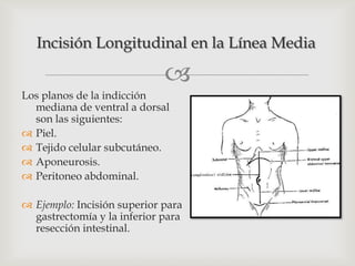 Incisiones quirúrgicas abdominales | PPTX