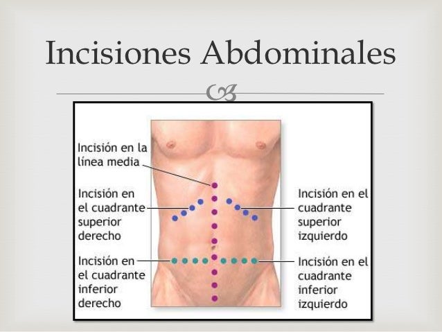 T tulos relacionados