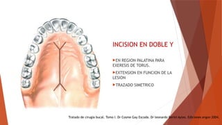 INCISIONES QUIRURGICAS EN CIRUGA ORAL.pptx
