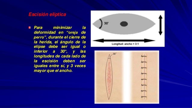 INCISION QUIRURGICA EN CARA Y CUELLO